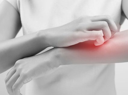 Artrite psoriática: sintomas e tratamento
