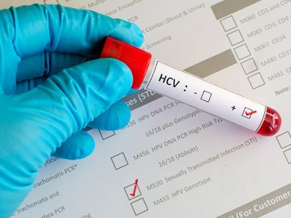 Hepatite C: transmissão, sintomas e tratamento