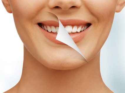 Manchas nos dentes: como remover e evitar