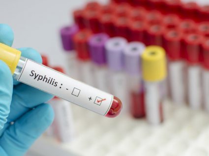 Sífilis: causas, sintomas e tratamento