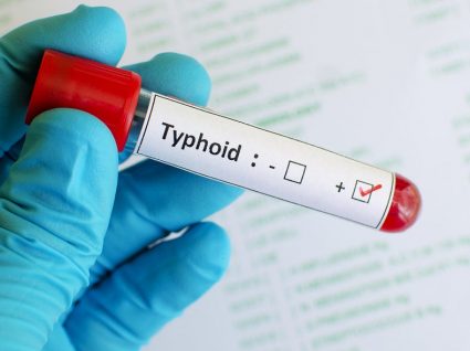 Febre tifoide: conheça os perigos desta doença