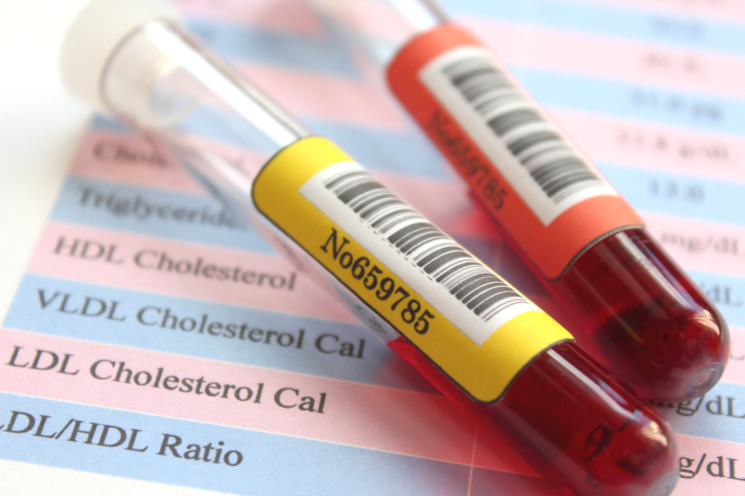 testes de colesterol