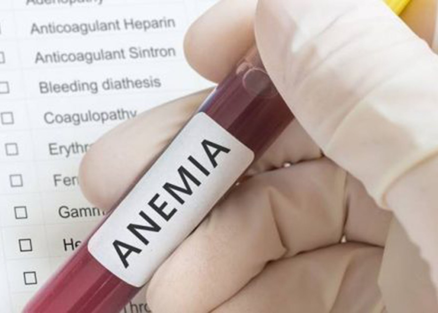 Análise clínica de anemia