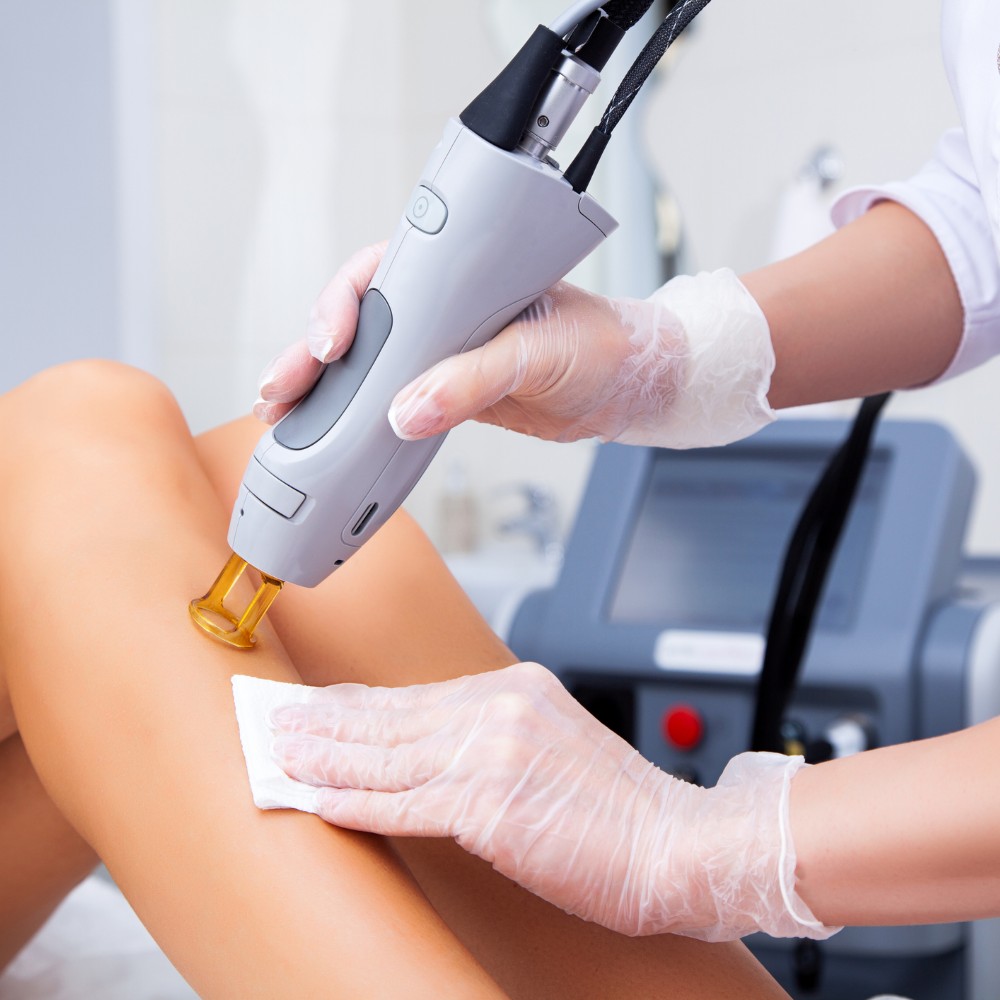 pernas de mulher a serem depiladas a laser com método alexandrite